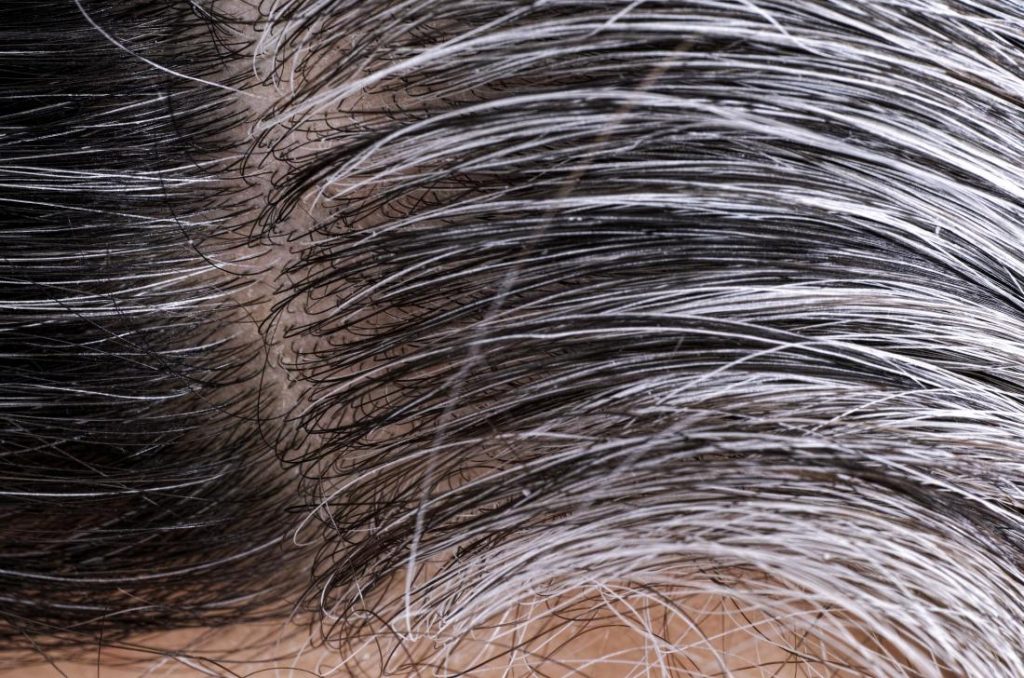Wellhealthorganic.com/Know the causes of white hair and easy ways to prevent it naturally
